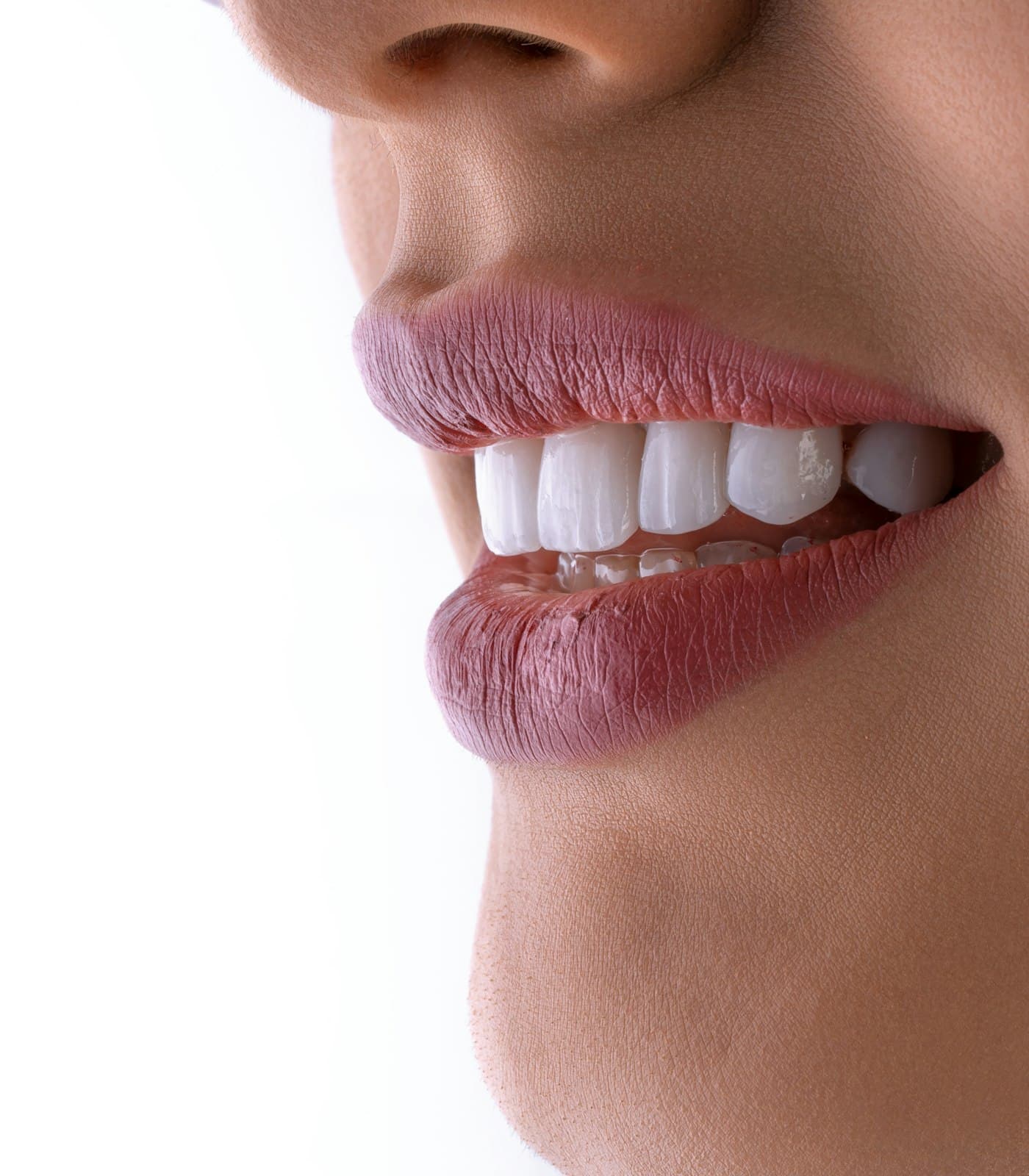 Teeth Whitening